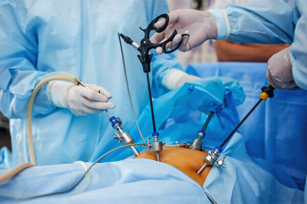 Λαπαροσκοπική γυναικολογική χειρουργική - Τέλος στις τομές!