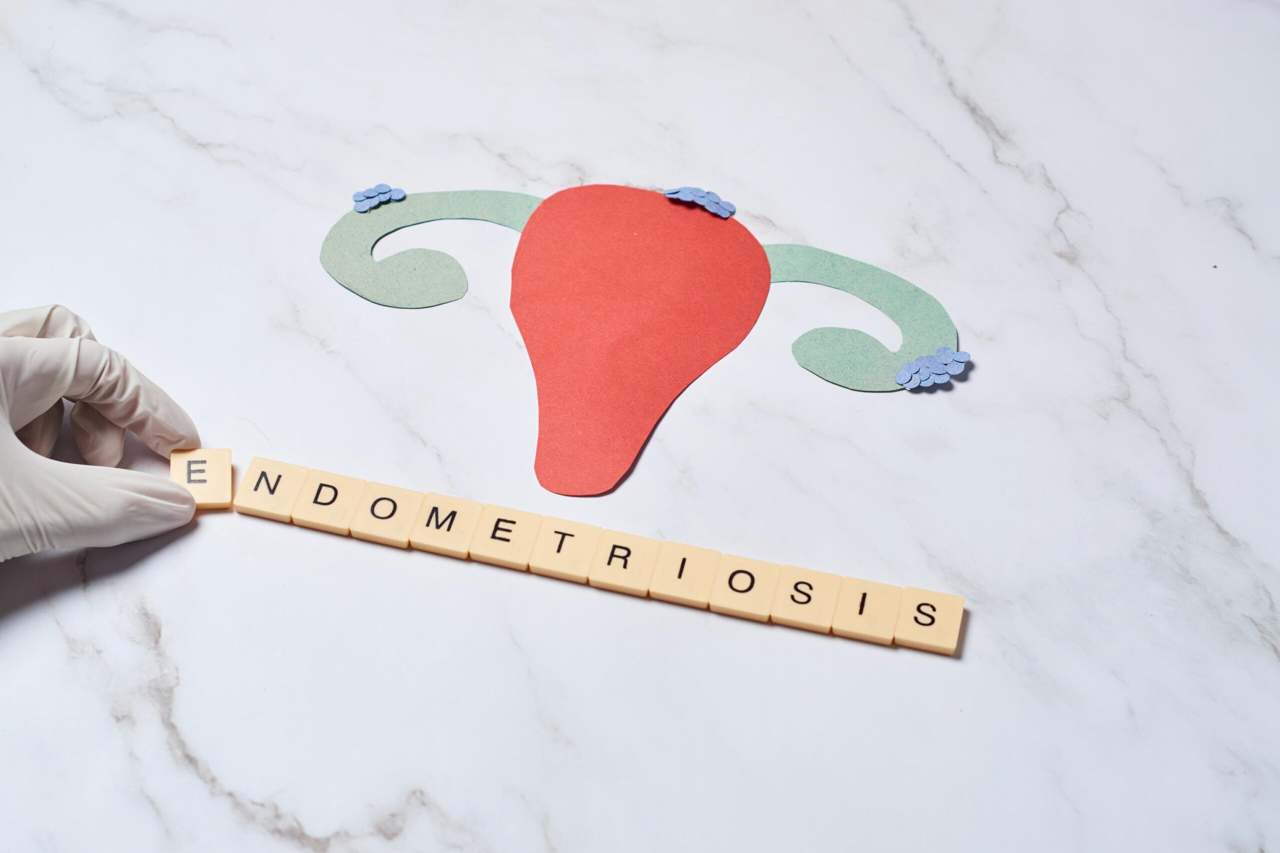 female uterus with endometriosis female wellness 2023 11 27 05 00 19 utc scaled