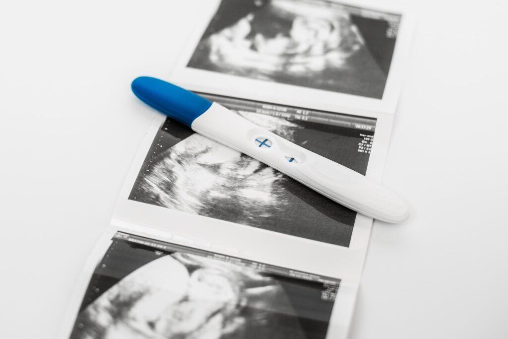 positive pregnancy test on ultrasound photo a pos 2023 11 27 05 27 07 utc
