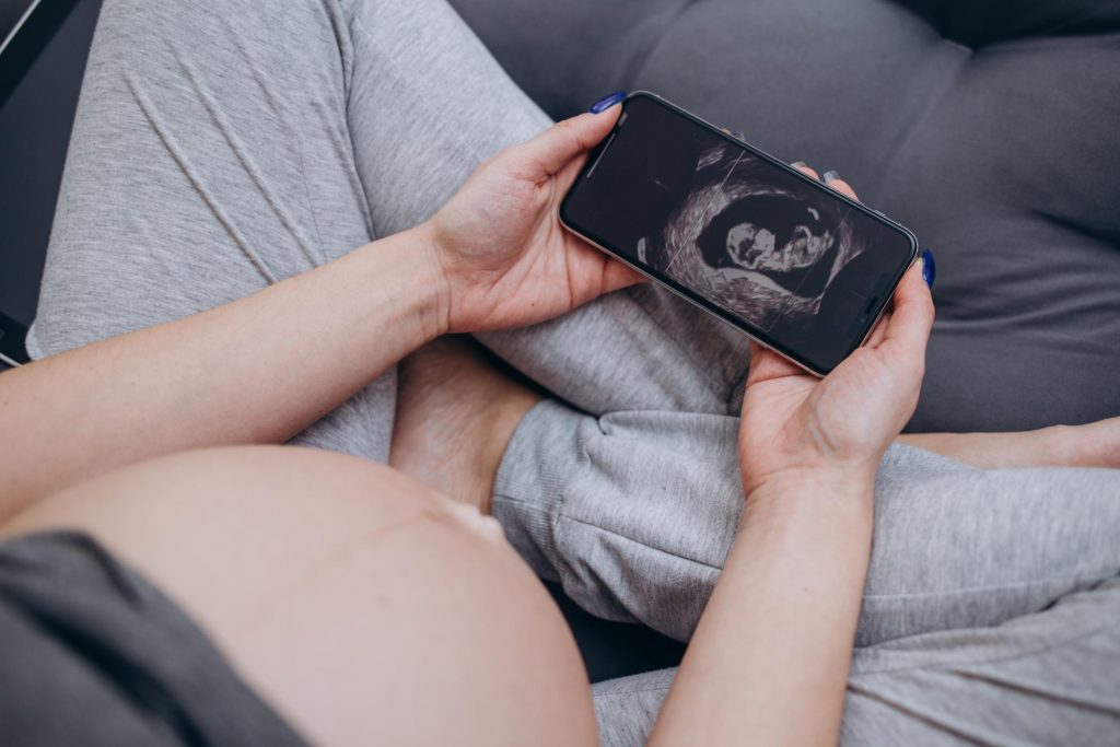 pregnant woman looking at ultrasound scan of baby 2023 11 27 05 02 31 utc