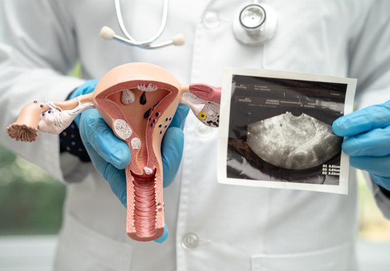 uterus and ovary doctor holding anatomy model and 2023 11 27 05 05 16 utc