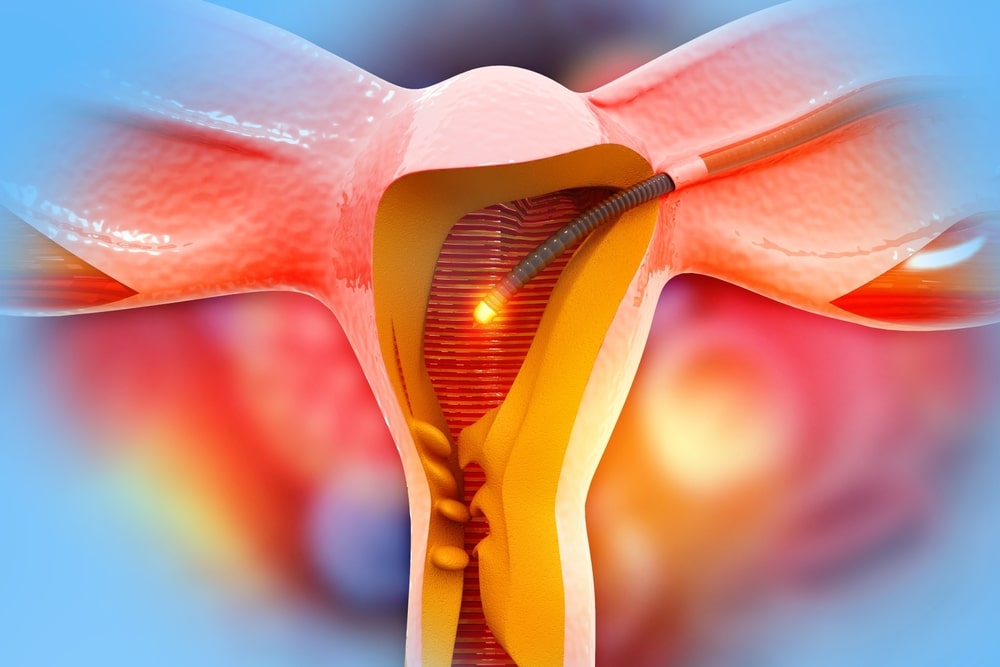 shutterstock 2226698585